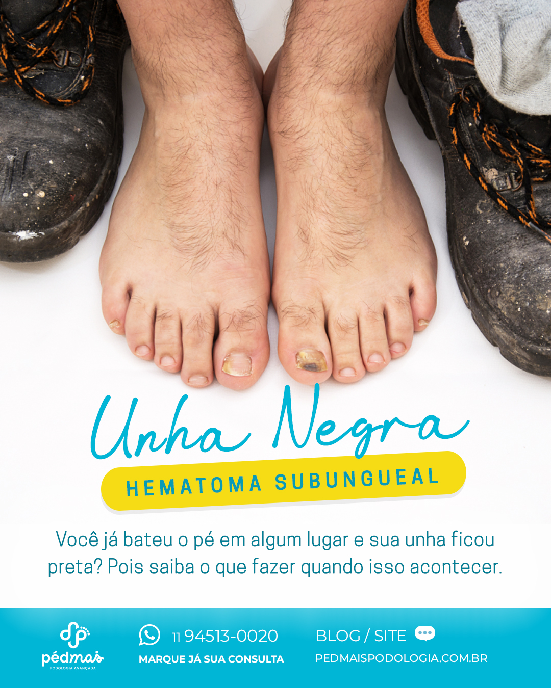 unha preta corredor