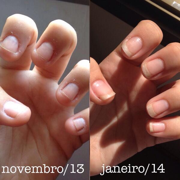 Guia Completo de Bases Fortalecedoras para Unhas Quebradiças