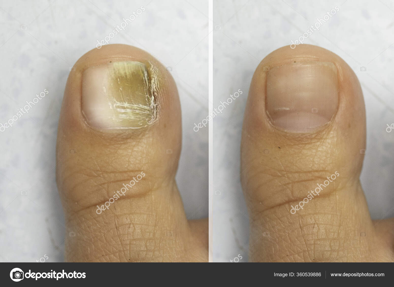 cuidados com unhas masculinas