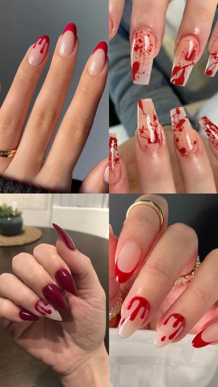 Hematoma Subungueal: Entendendo a Unha Roxa ou Preta