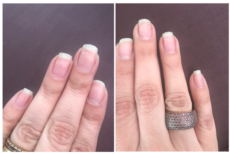 unhas ressecadas por esmalte