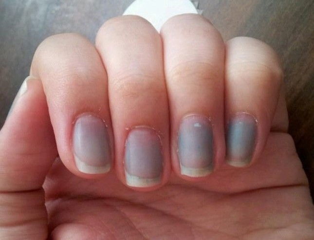 Guia Completo de Antifúngicos para Onicomicose