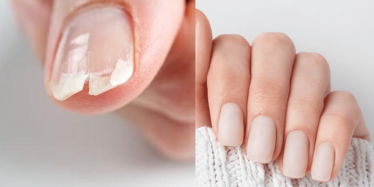 Por Que Minhas Unhas Quebram Tanto? Causas e Soluções para Unhas Fracas