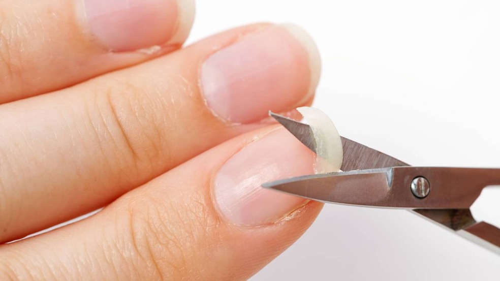 Unha Quebrou na Carne? Saiba o Que Fazer para Evitar Infecções