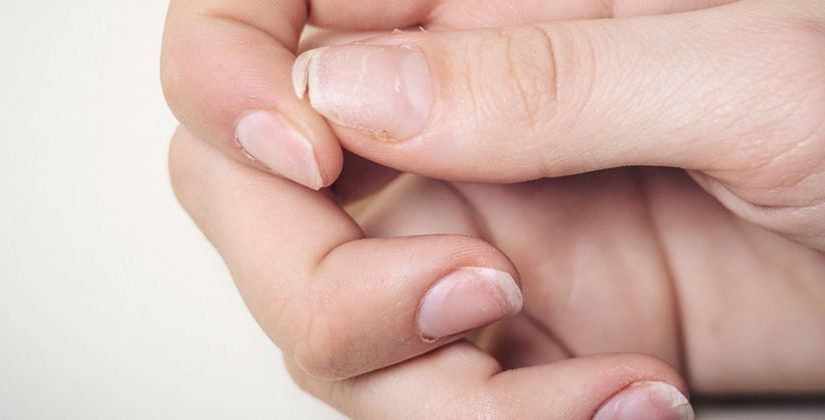 Por Que Minhas Unhas Quebram Tanto? Causas e Soluções para Unhas Fracas
