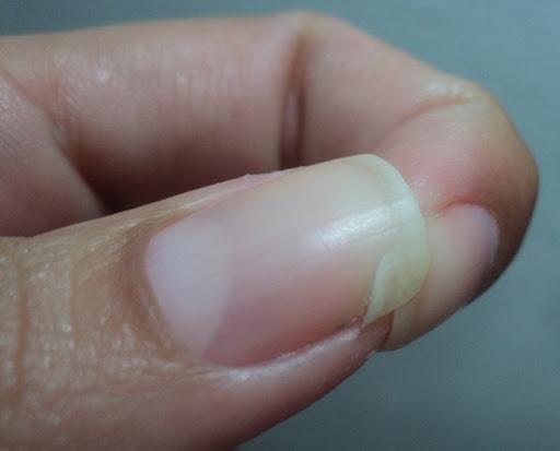 Métodos Caseiros para Reparar Unhas Trincadas: Saquinho de Chá, Algodão e Mais