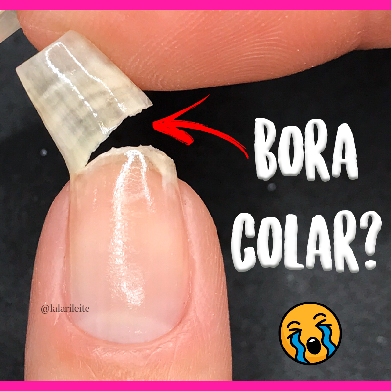 A Relação entre Saúde da Tireoide, Deficiências Nutricionais e Unhas Quebradiças