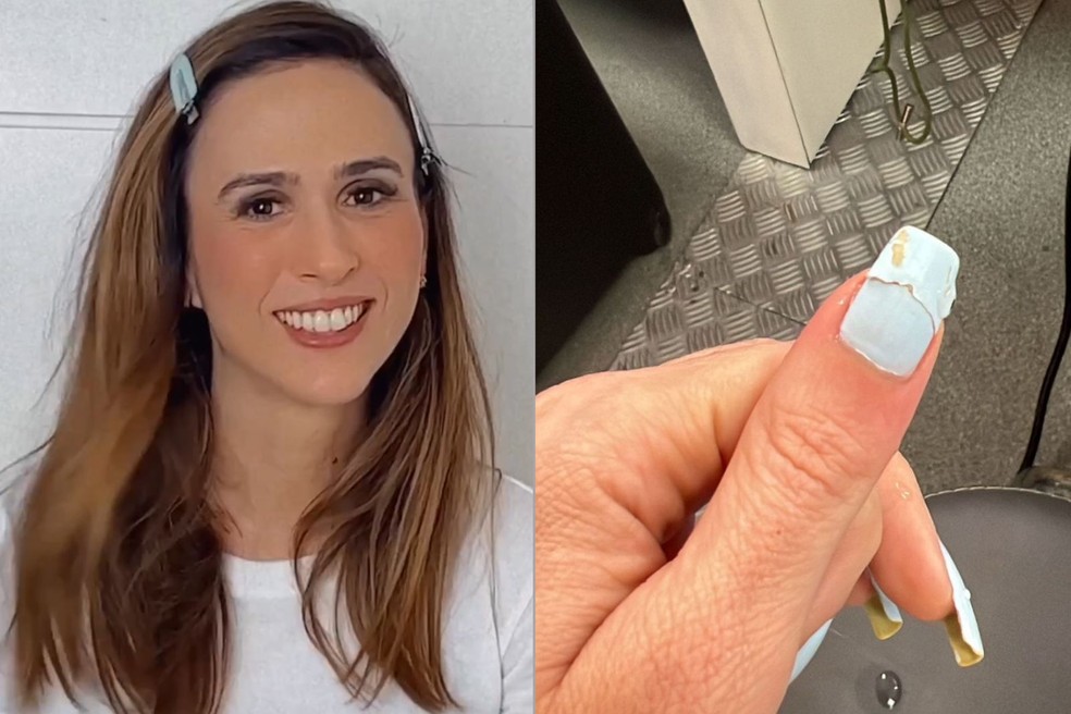 Por Que Minhas Unhas Quebram Tanto? Causas e Soluções para Unhas Fracas