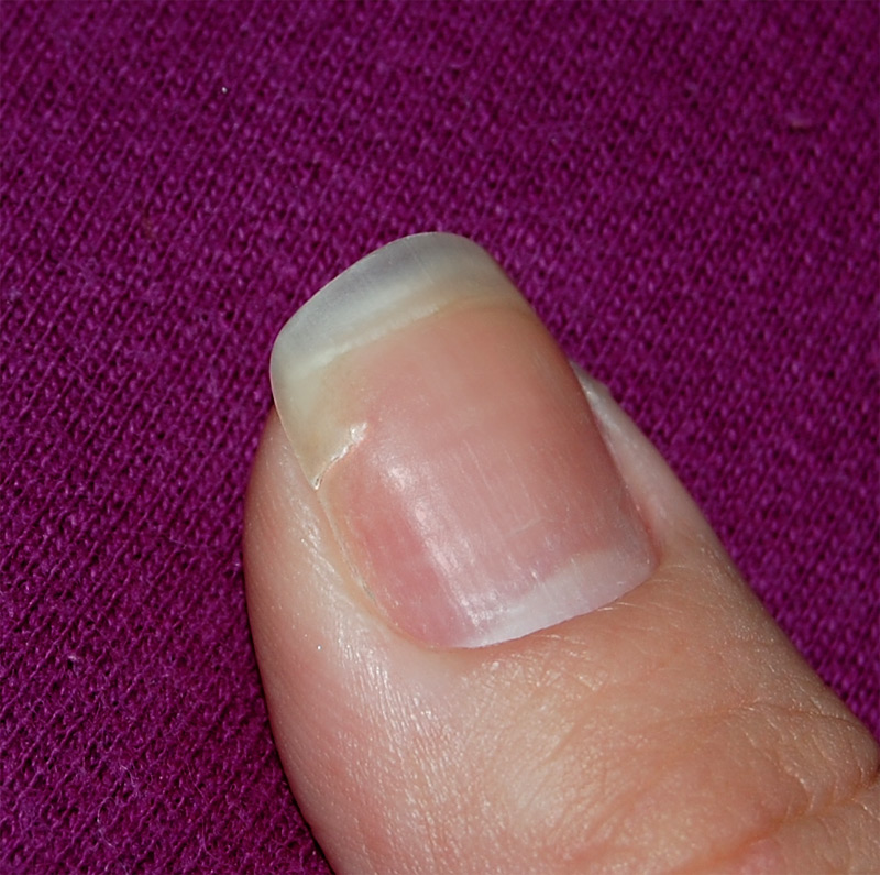 Como Prevenir Unhas Quebradas: Dicas Essenciais para o Dia a Dia