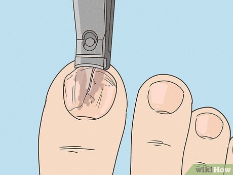 Guia Completo: Produtos e Ferramentas para Cuidar de Unhas Danificadas