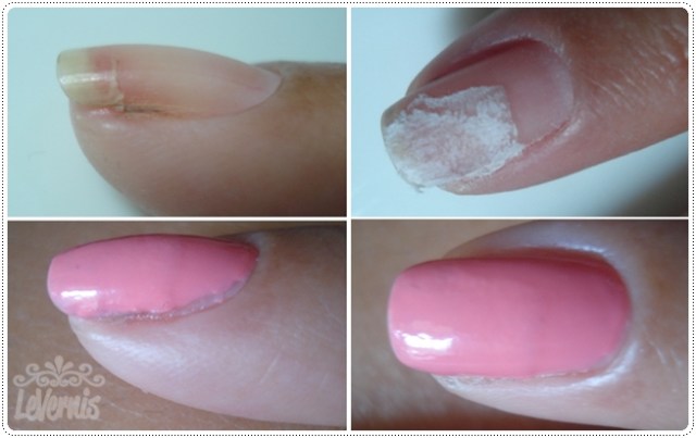 Diferença entre Unha Quebrada, Rachada e Descolada: Saiba Identificar