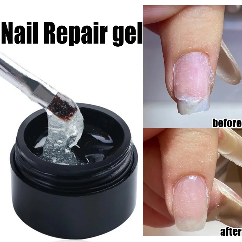 erros comuns ao tratar unha rachada que pioram o problema