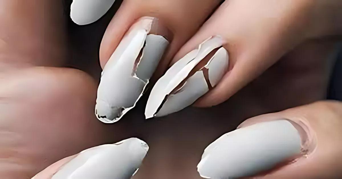 Onicopapiloma: O que é e como identificar uma unha rachada suspeita