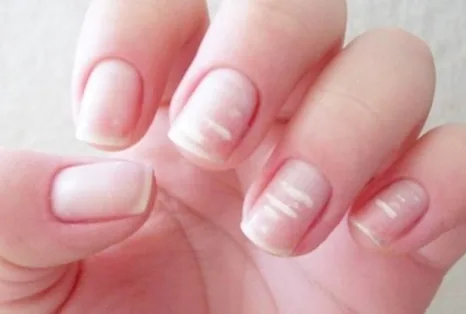 inspiração para unhas rachadas