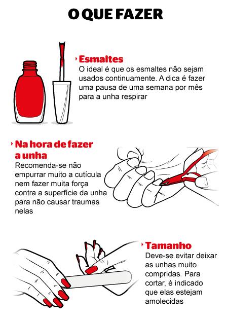 como a matriz ungueal afeta o crescimento da unha