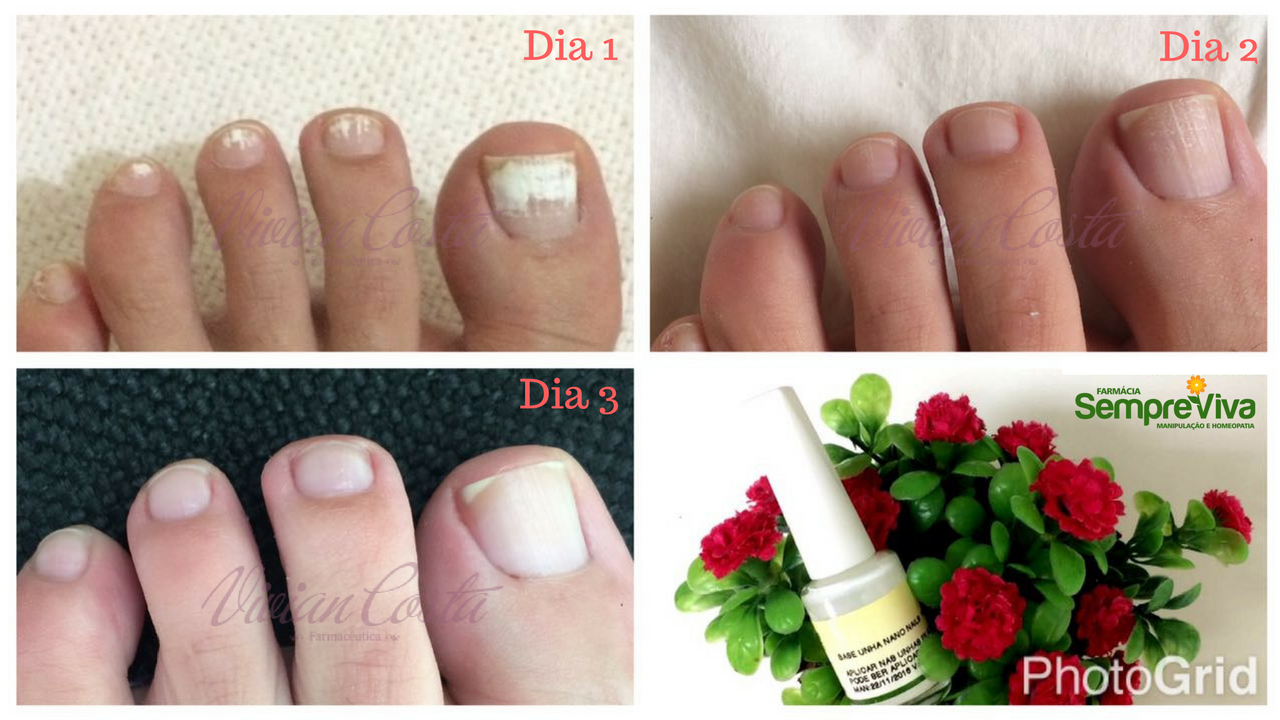 tratamento para unhas opacas