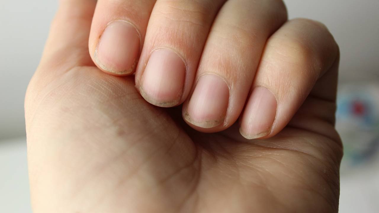 unhas descamando o que fazer