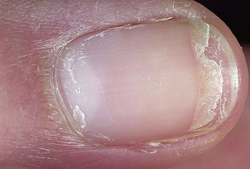 creme para unhas ressecadas
