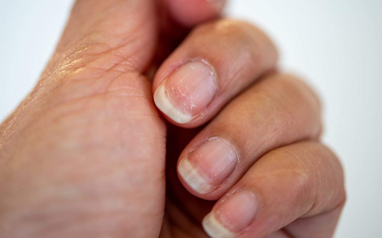 como hidratar unhas