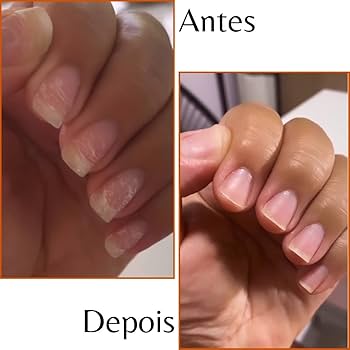 cuidados com unhas no inverno