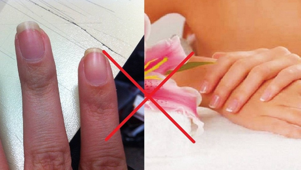 nutrição para unhas