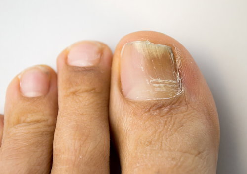 saúde das unhas e corpo