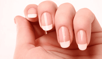 tratamento para unhas quebradiças