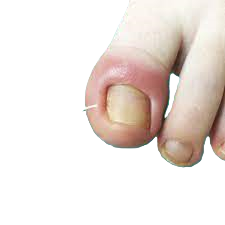 Guia Completo de Prevenção: Dicas Essenciais para Manter Suas Unhas Saudáveis