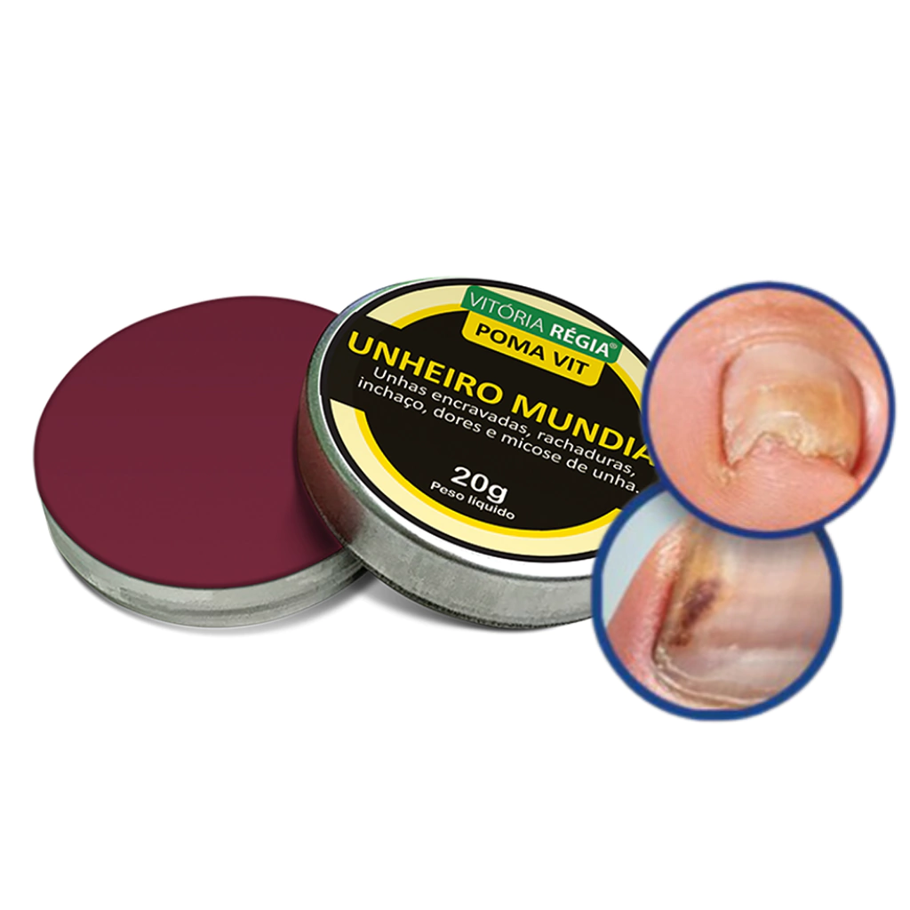 Quando Procurar um Dermatologista para Problemas nas Unhas: Sinais de Alerta