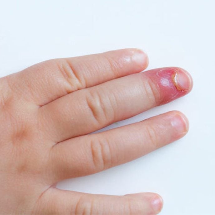 Guia Completo de Prevenção: Dicas Essenciais para Manter Suas Unhas Saudáveis