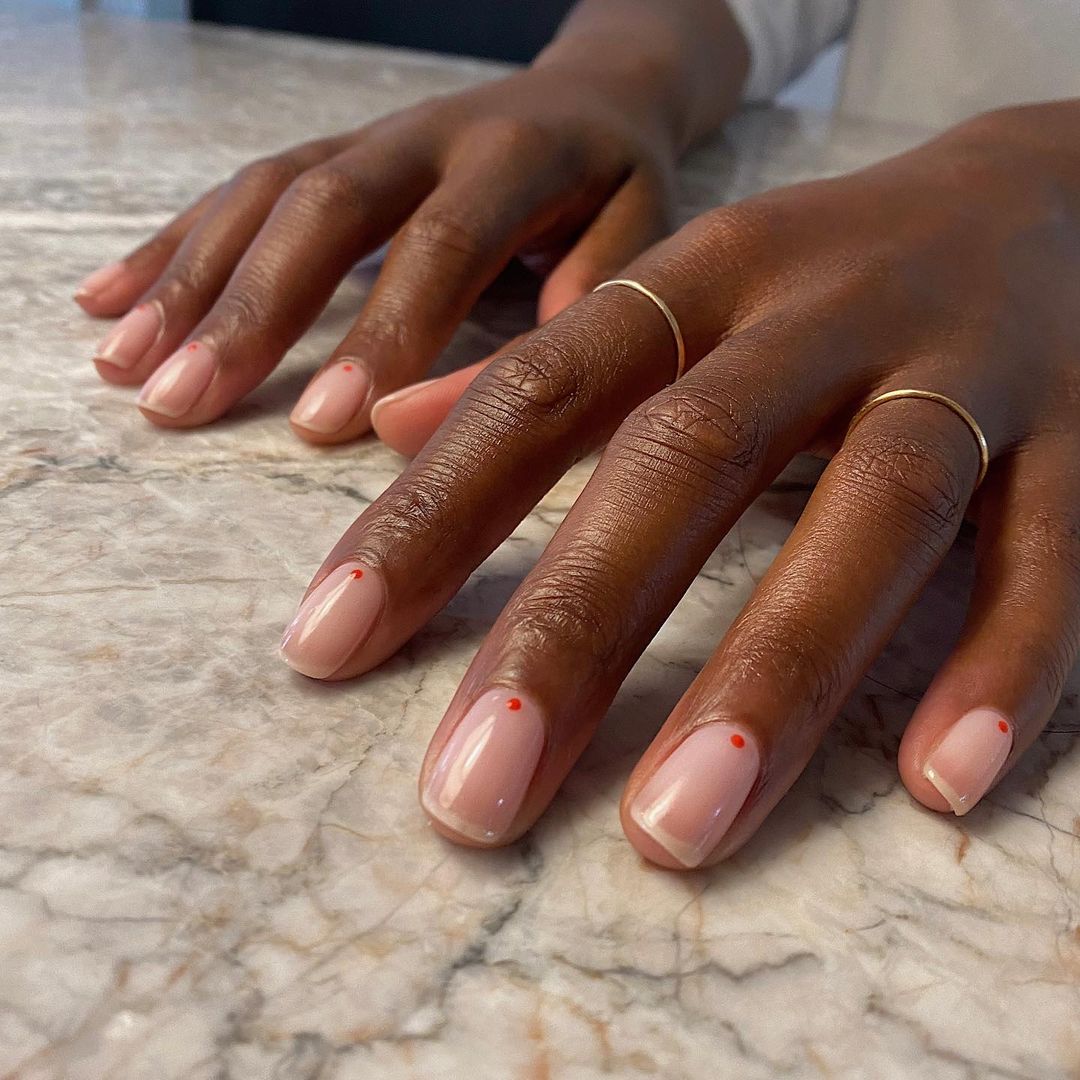 unheiro na unha da mão