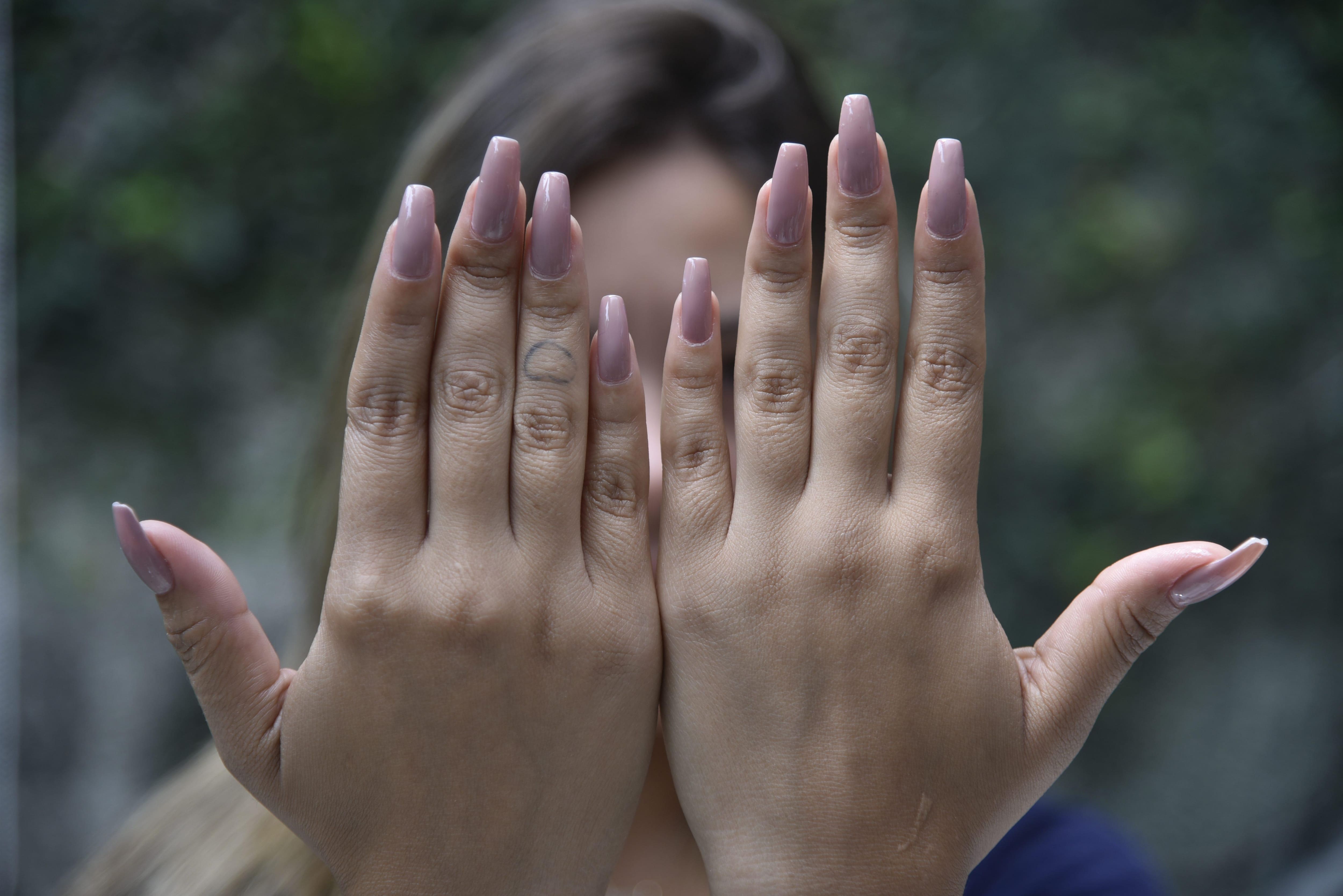 Causas e Opções de Tratamento Tópico e Oral