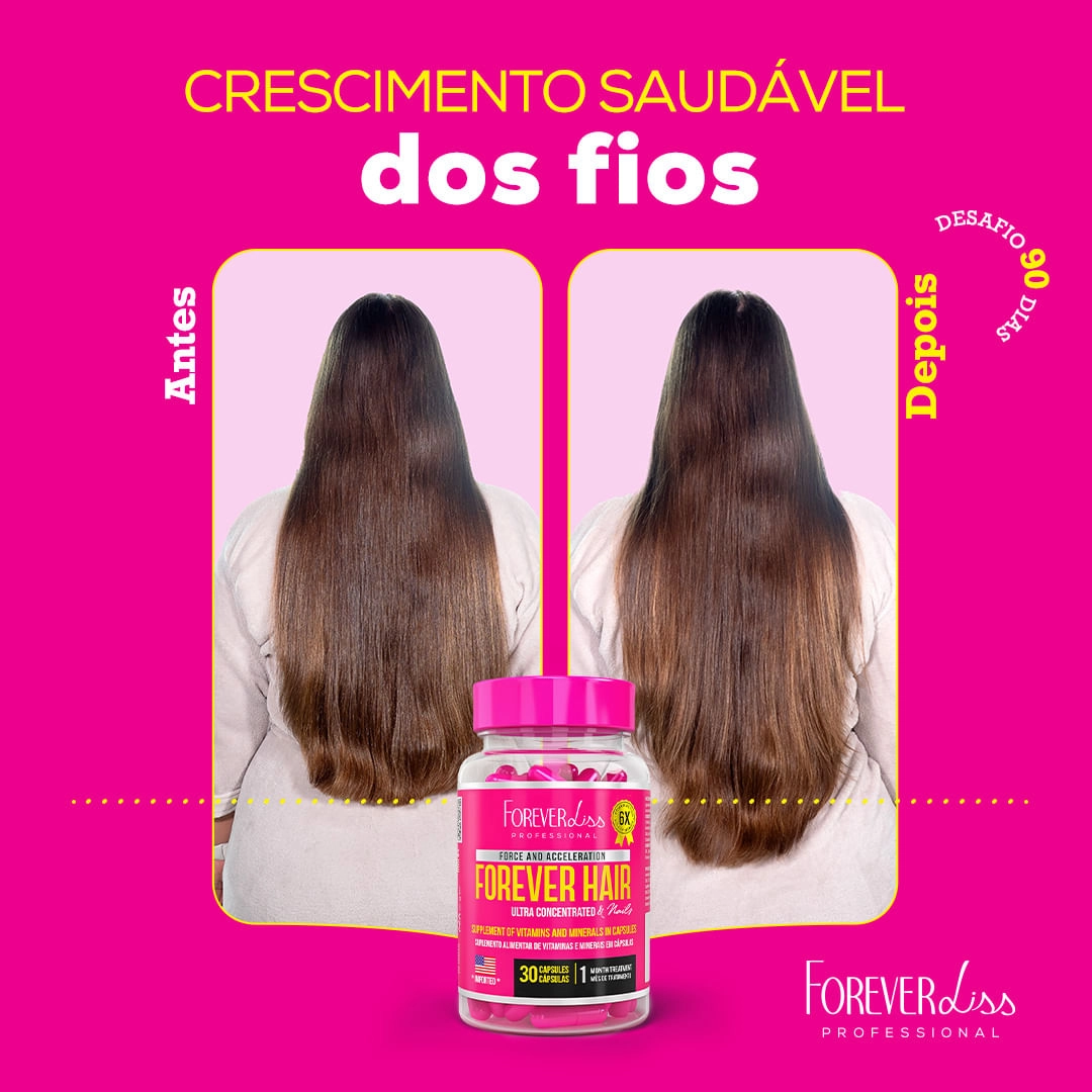 5 ideias de títulos:
1. Biotina: O Segredo para Cabelos e Unhas Fortes
2. Zinco e Colágeno: A Dupla Essencial para a Saúde Capilar
3. Suplementos para Cabelos e Unhas: Guia Completo de Marcas
4. Tempo de Resultado: Quando Esperar Mudanças com Suplementos Capilares?
5. Cuidados Essenciais ao Usar Vitaminas para Cabelo e Unhas